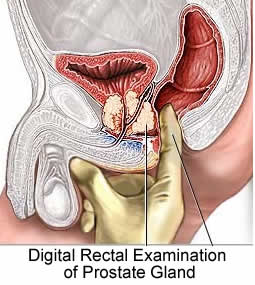 prostate enlargement treatment